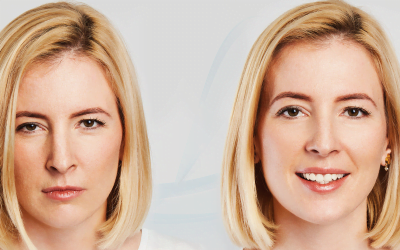 O Estresse pode prejudicar a minha pele?