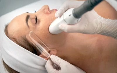5 benefícios do lifting facial não-invasivo