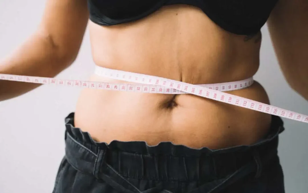 Umbigo triste e flacidez abdominal