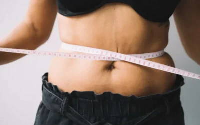 Umbigo triste e flacidez abdominal